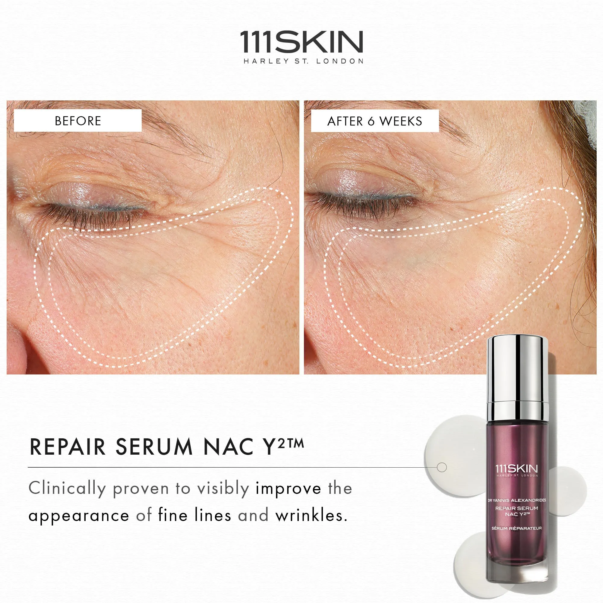Repair Serum NAC Y2